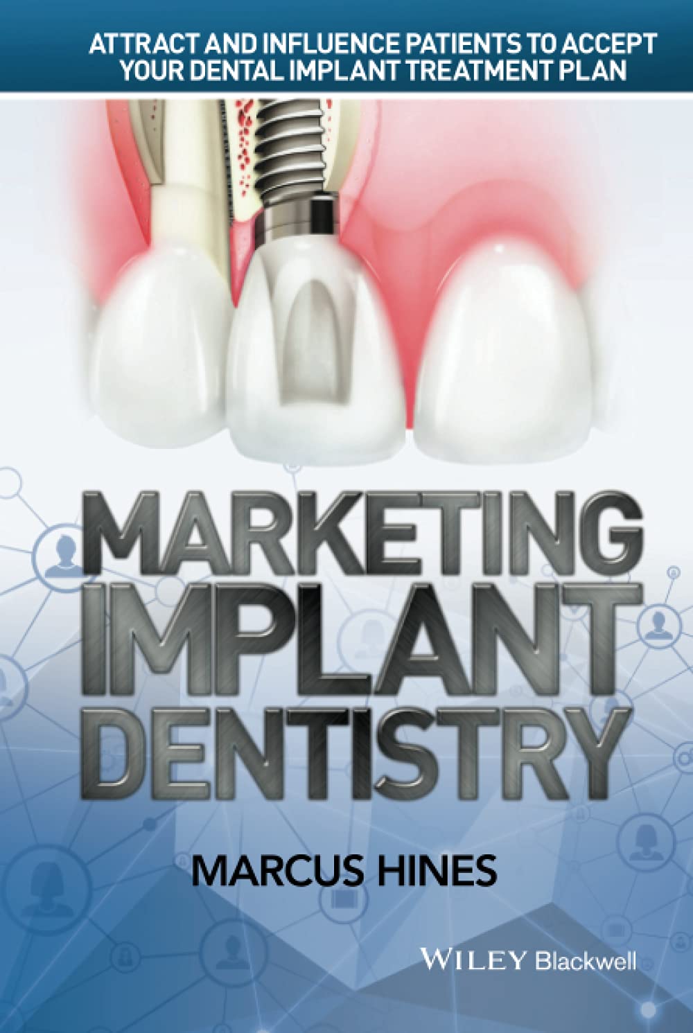 Marketing Implant Dentistry