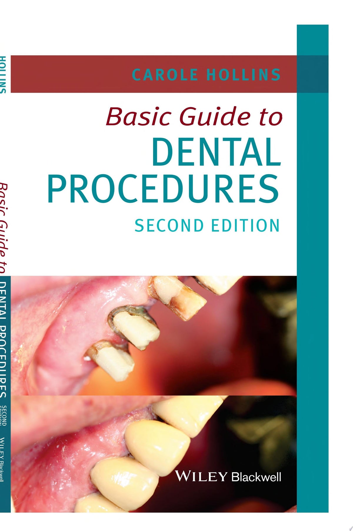 Basic Guide to Dental Procedures
