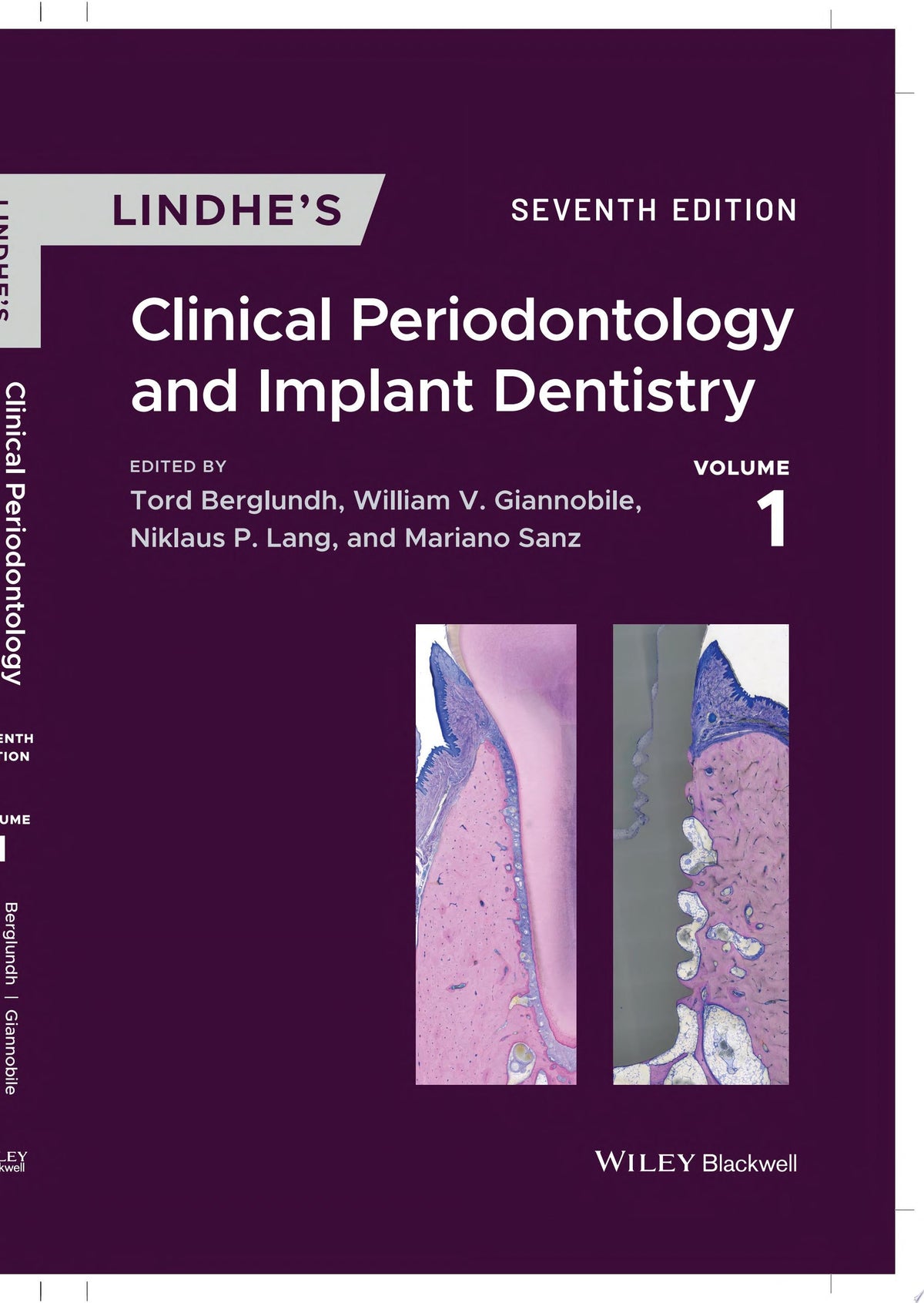 Lindhe's Clinical Periodontology and Implant Dentistry, 2 Volume Set