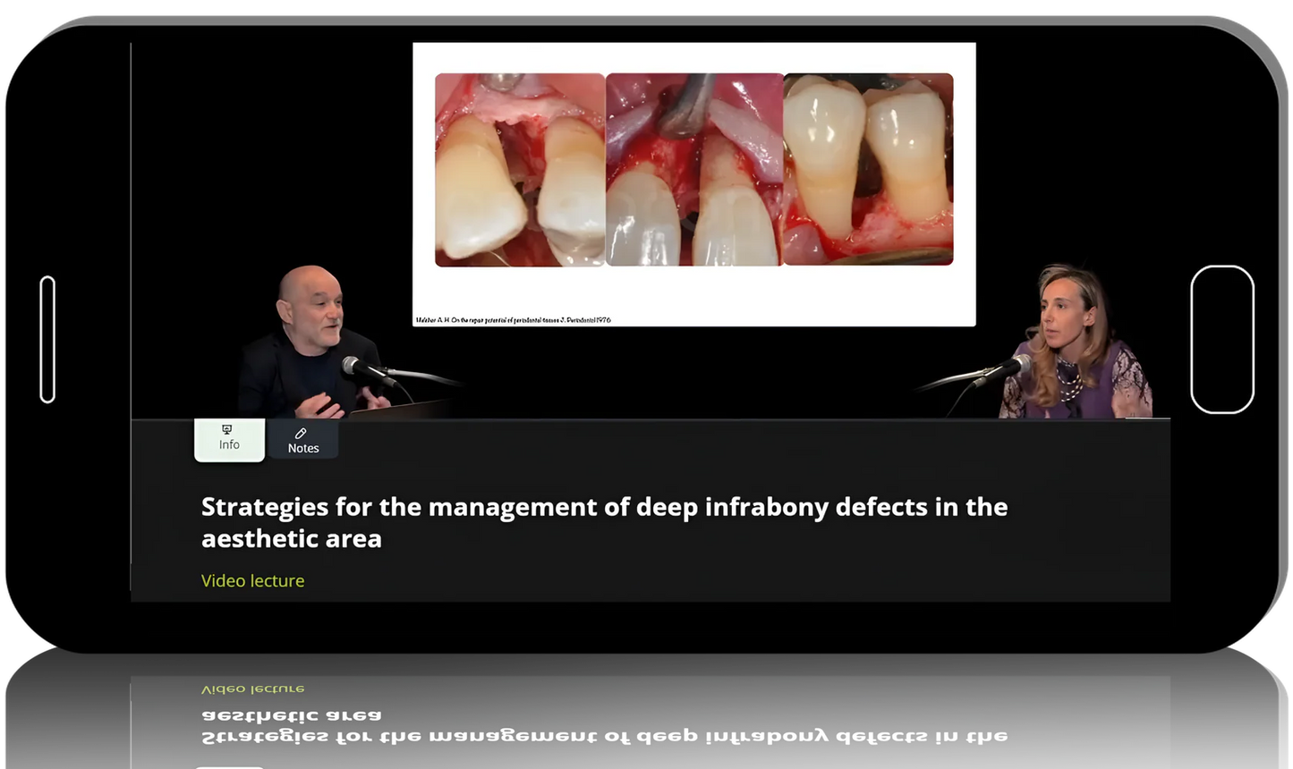 Papilla Preservation & Regeneration: Techniques for Infrabony Defects