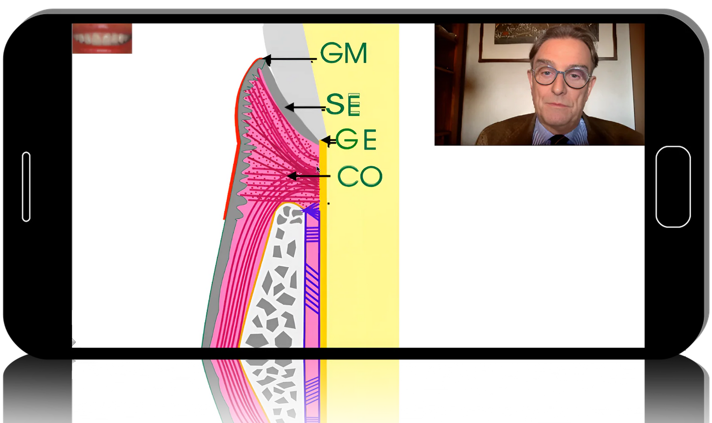 Surgical periodontics: preparation for prosthetics