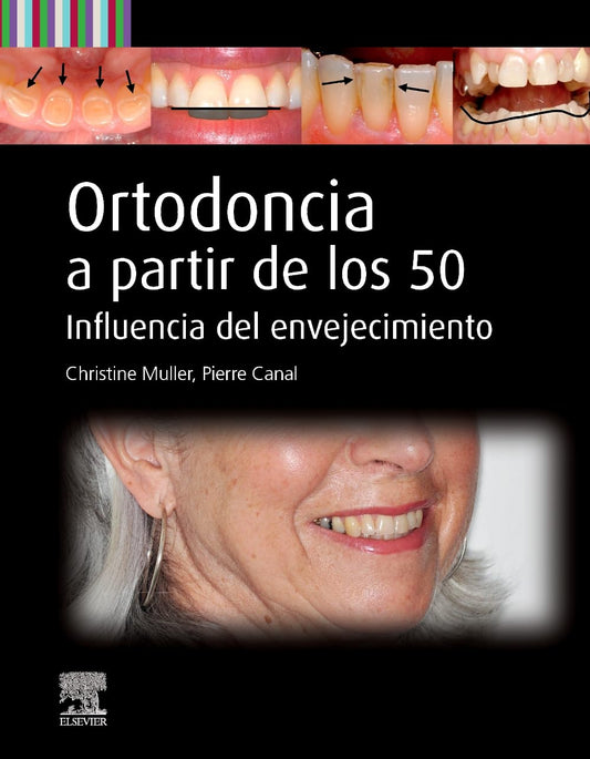 Ortodoncia a partir de los 50: Influencia del envejecimiento -2025