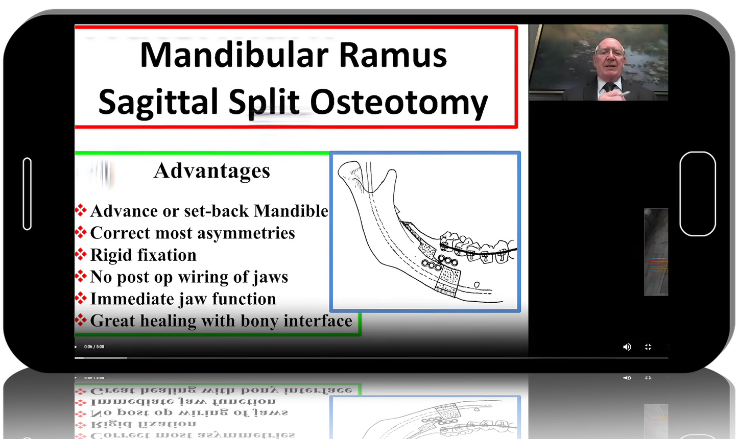 Orthognathic and TMJ surgery