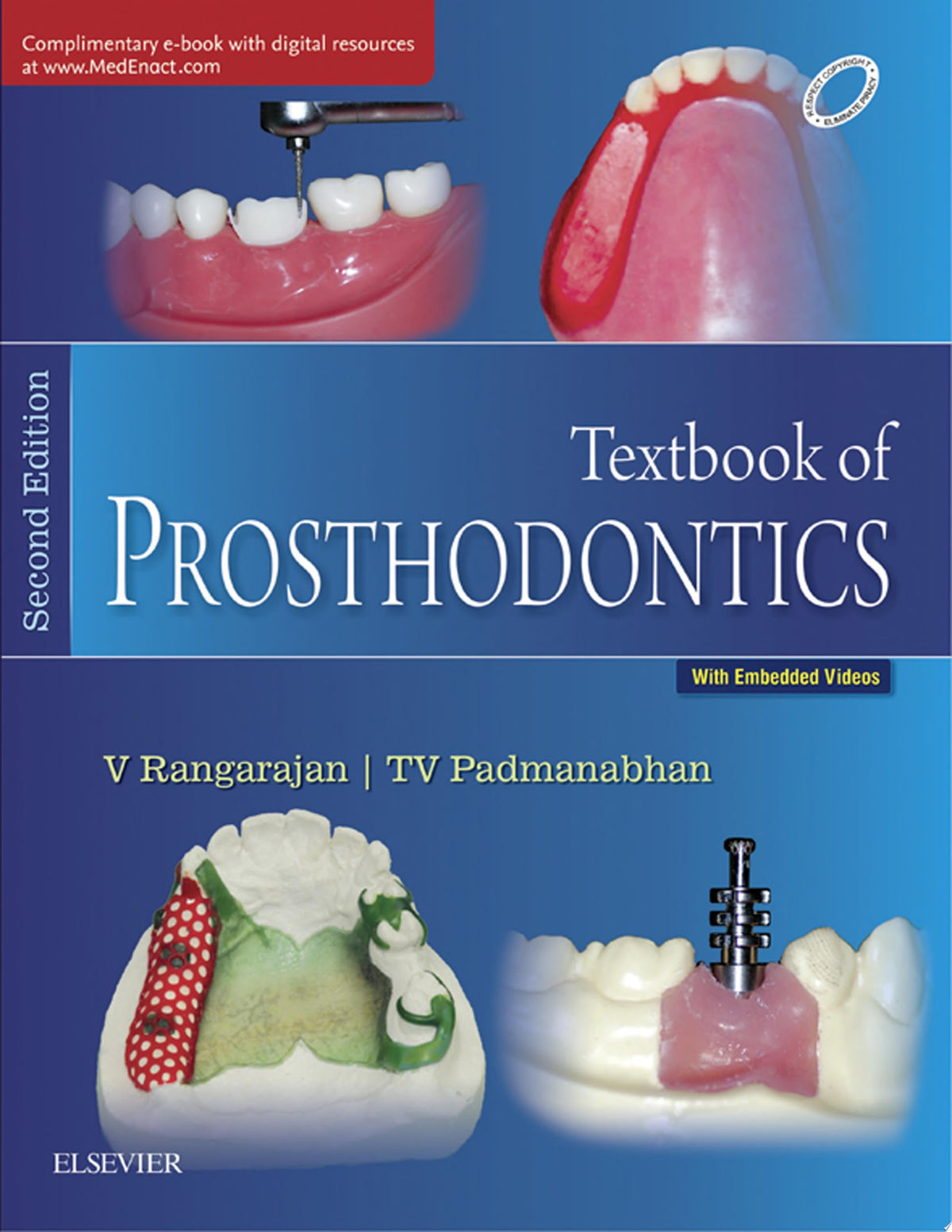Textbook of Prosthodontics- E Book