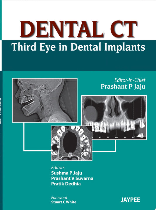 Dental CT Third Eye in Dental Implants