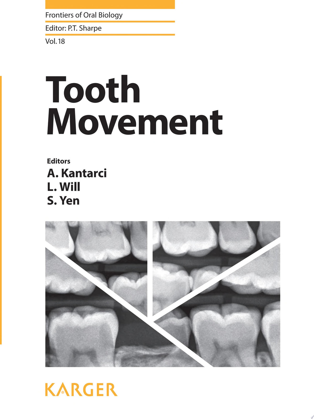 Tooth Movement