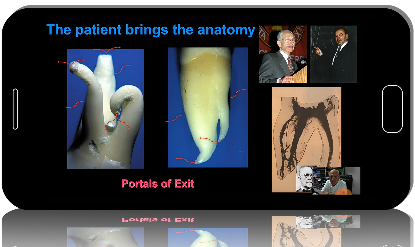 Working Length in Endodontics
